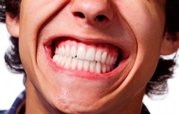 En mann som lider av tanngnissing