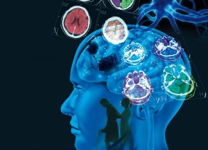 Multippel sklerose: Årsaker, symptomer og behandling