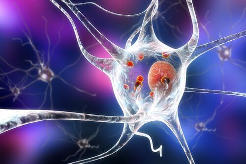 tidlig utbrudd Parkinson er på cerebralt nivå