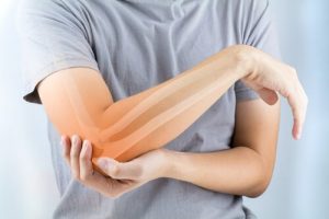 Revmatoid artritt: symptomer, årsaker, og behandling