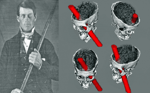 phineas-gage