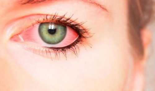 Det er flere ideer som handler om hvorvidt røde øyne kan være et spor psykisk vold etterlater på kroppen