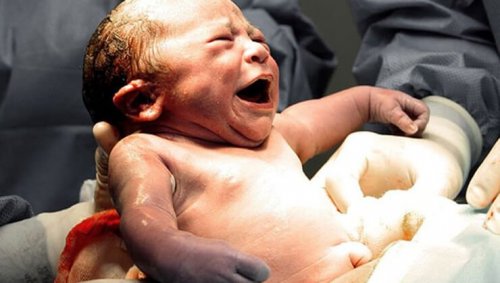 baby opplever fødselstraume