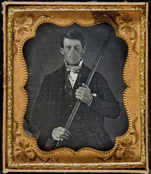 Et innrammet bilde av Phineas Gage