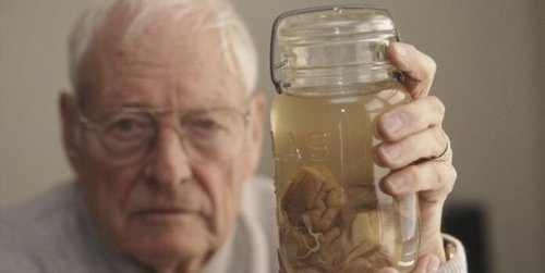 Thomas Harvey og Einsteins hjerne