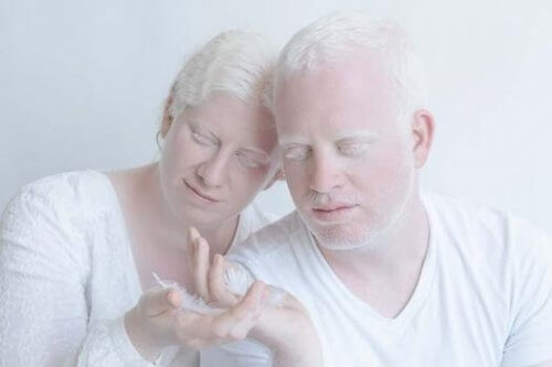 Par som lever med albinisme.