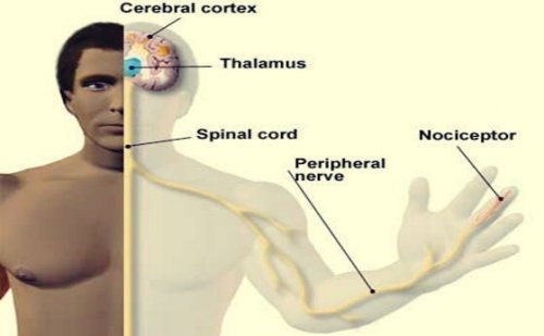 En mann med aksoner og nociceptorer.