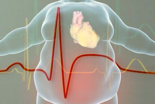 overvektige mennesker har større sannsynlighet for hjerteproblemer