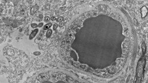 Hjernens mikrobiom: tarmbakterier i hjernen