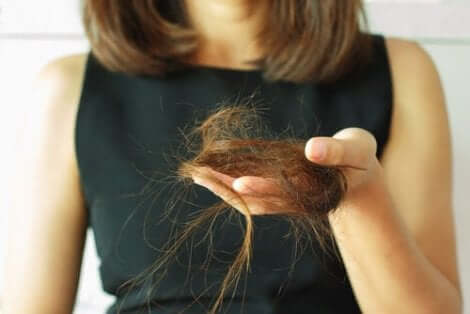 Det finnes flere typer av alopecia hos kvinner.