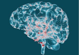 Huntingtons sykdom - Karakteristikker og symptomer