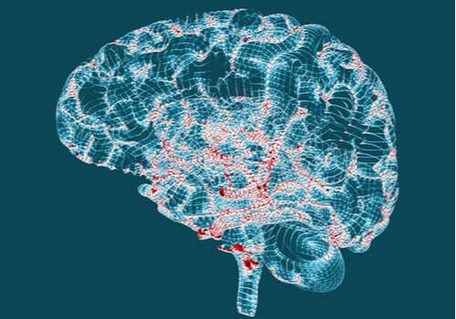 Huntingtons sykdom - Karakteristikker og symptomer