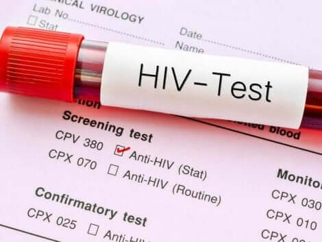 Verdens AIDS-dag ønsker å spe kunnskap, s¨vel som å få folk til å teste seg, slik at de kan begynne behandling så tidlig som mulig.