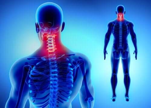 Symptomer på nakkesleng inkluderer muskelsmerter. 