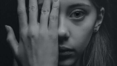 Kvinne som dekker det ene øyet.