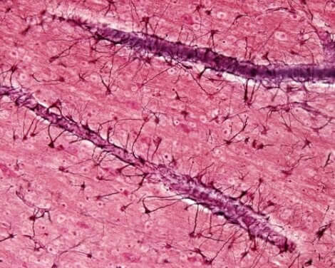 Et bilde av astrocytter.