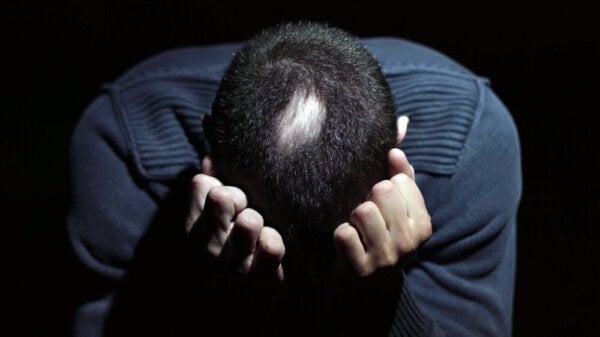 Koblingen mellom alopecia areata og stress