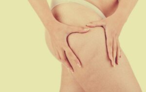 Lipødem: utover fedme